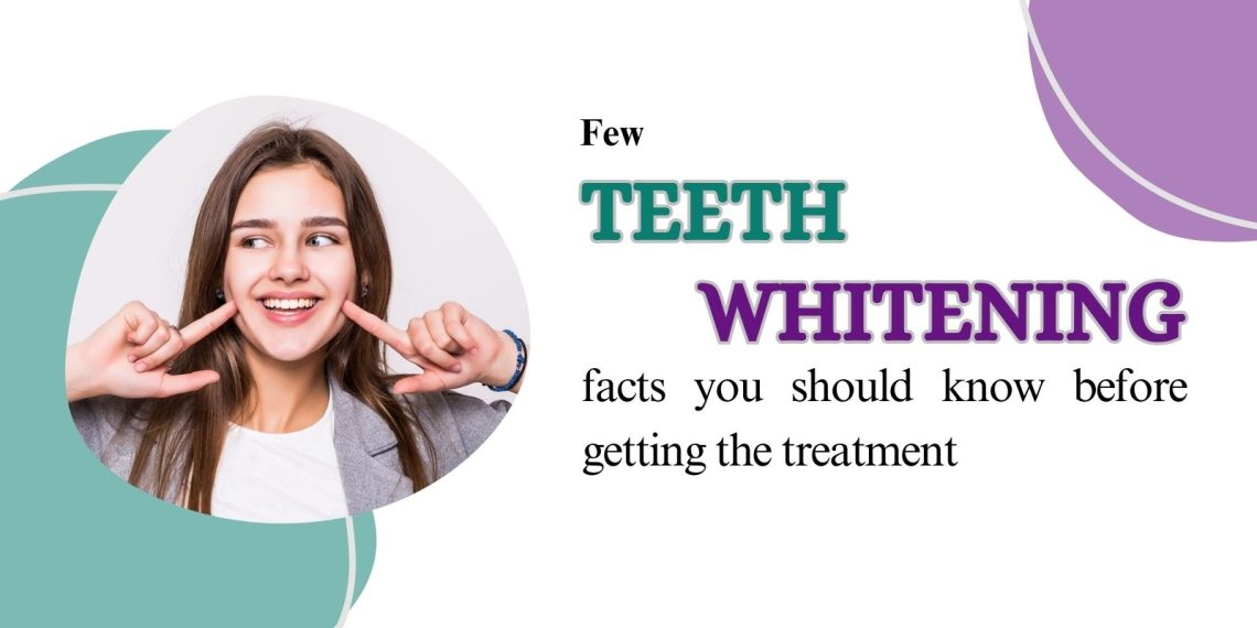 Few teeth whitening facts you should know before getting the treatment