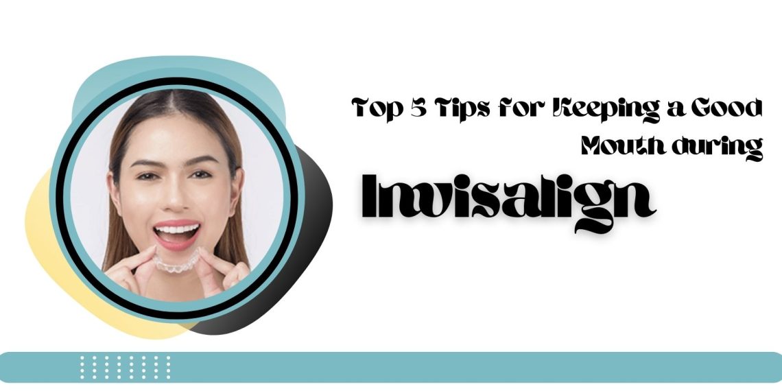 Top 5 Tips for Keeping a Good Mouth during Invisalign Treatment